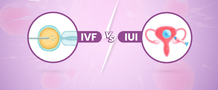 IVF-IUI